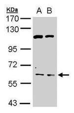 Acetylcholinesterase Antibody in Western Blot (WB)