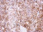 ADORA2A Antibody in Immunohistochemistry (Paraffin) (IHC (P))