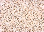 RAD9 Antibody in Immunohistochemistry (Paraffin) (IHC (P))