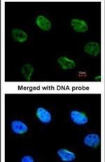 MUS81 Antibody in Immunocytochemistry (ICC/IF)