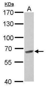 MUS81 Antibody in Western Blot (WB)