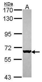 MUS81 Antibody in Western Blot (WB)
