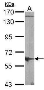 MUS81 Antibody in Western Blot (WB)