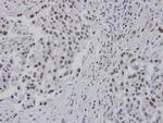 RPA14 Polyclonal Antibody