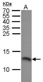 RPA14 Antibody in Western Blot (WB)
