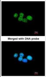 ERCC8 Antibody in Immunocytochemistry (ICC/IF)
