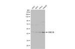 ERCC8 Antibody in Western Blot (WB)