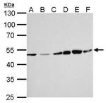 ERCC8 Antibody in Western Blot (WB)
