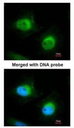 Cofilin 2 Antibody in Immunocytochemistry (ICC/IF)