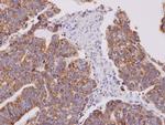 Cofilin 2 Antibody in Immunohistochemistry (Paraffin) (IHC (P))