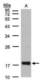 Cofilin 2 Antibody in Western Blot (WB)