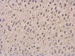 Dynactin 1 Antibody in Immunohistochemistry (Paraffin) (IHC (P))