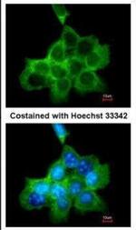 DOCK1 Polyclonal Antibody
