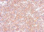 EML1 Antibody in Immunohistochemistry (Paraffin) (IHC (P))