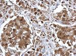 EPS8 Antibody in Immunohistochemistry (Paraffin) (IHC (P))