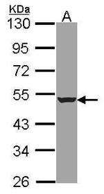 HADHB Antibody in Western Blot (WB)