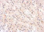 Complement Factor H Polyclonal Antibody