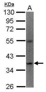 Apelin receptor Antibody in Western Blot (WB)