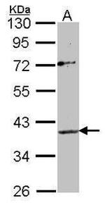Apelin receptor Antibody in Western Blot (WB)