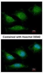 POLG Polyclonal Antibody