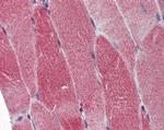 POLG Antibody in Immunohistochemistry (Paraffin) (IHC (P))