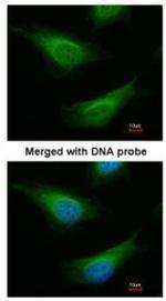 FANCC Antibody in Immunocytochemistry (ICC/IF)