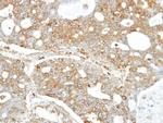 FANCC Antibody in Immunohistochemistry (Paraffin) (IHC (P))