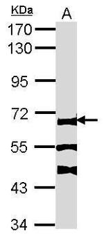 FANCC Antibody in Western Blot (WB)