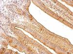 Tartrate Resistant Acid Phosphatase Antibody in Immunohistochemistry (Paraffin) (IHC (P))