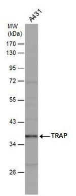 Tartrate Resistant Acid Phosphatase Antibody in Western Blot (WB)