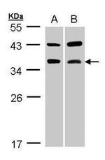 Tartrate Resistant Acid Phosphatase Antibody in Western Blot (WB)