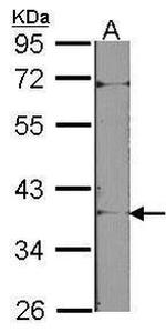 Tartrate Resistant Acid Phosphatase Antibody in Western Blot (WB)