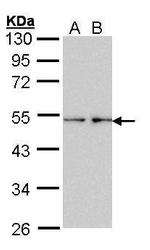 Fascin Polyclonal Antibody