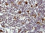HICE1 Antibody in Immunohistochemistry (Paraffin) (IHC (P))