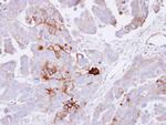 ALPL Polyclonal Antibody