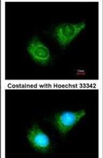Caspase 8 Antibody in Immunocytochemistry (ICC/IF)