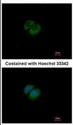 HPRT1 Polyclonal Antibody