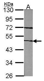Factor VII Polyclonal Antibody