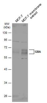 GBA Antibody in Western Blot (WB)