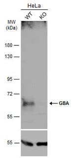 GBA Antibody in Western Blot (WB)