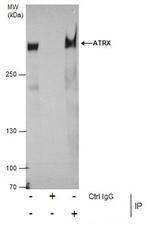 ATRX Antibody in Immunoprecipitation (IP)
