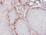 ASS1 Polyclonal Antibody
