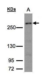 CAD Antibody in Western Blot (WB)