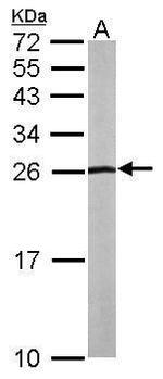 NHERF2 Polyclonal Antibody