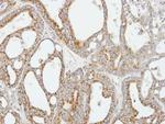 COX5B Polyclonal Antibody