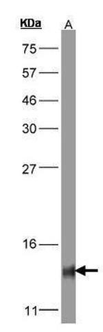 COX5B Antibody in Western Blot (WB)