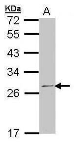RPL14 Polyclonal Antibody