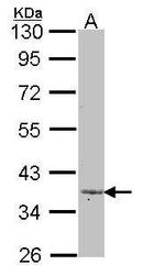 LEFTY2 Antibody in Western Blot (WB)