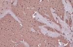 Acetylcholinesterase Antibody in Immunohistochemistry (Paraffin) (IHC (P))