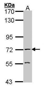 Acetylcholinesterase Antibody in Western Blot (WB)